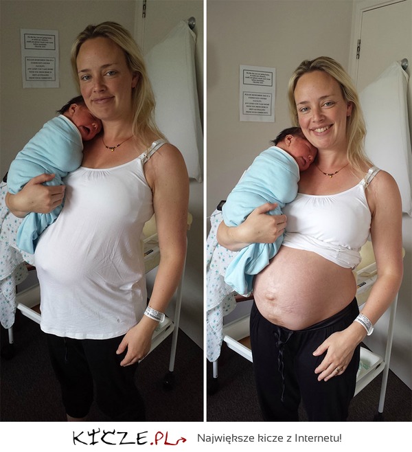 Ta kobieta pokazała, jak naprawdę wygląda jej ciało po porodzie!