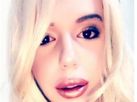 Być jak Kim, Britney lub Angelina – przerażające operacje plastyczne