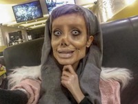 Chciała wyglądać jak Angelina Jolie. Przeszła 50 operacji i została oszpecona!